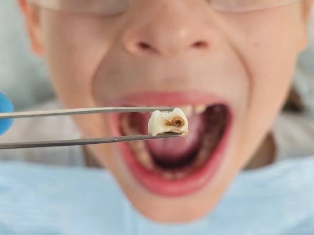 Best Cracked Tooth Emergency Dentist  in Cookeville, TN